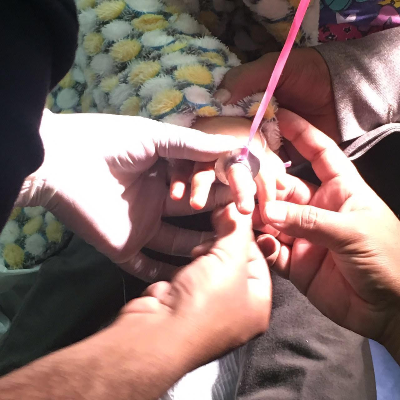 بالصور.. مدني العلا يحرّر إصبع طفلة من حلقةٍ معدنية