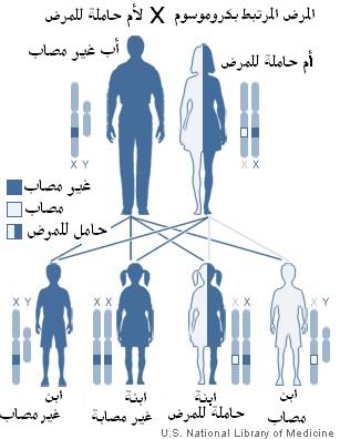 مرض الهيموفيليا تورثه الأم لأبنائها الذكور فقط ولا تصاب به