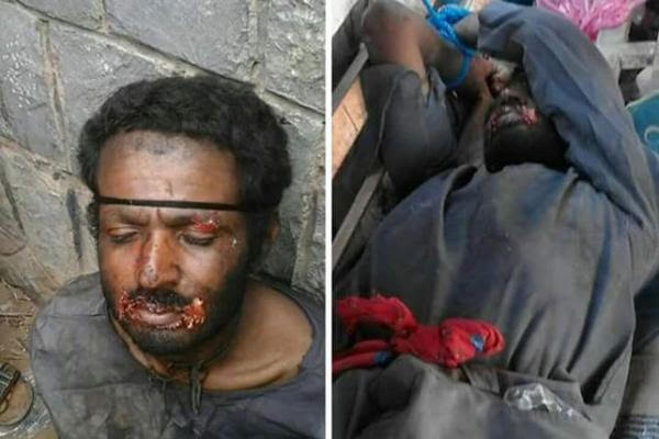 صورة.. القبض على “مصاص الدماء” اليمني