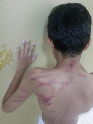 والد الطالب علي العتيبي لـ”المواطن”: معلم ضرب ابني بلا رحمة ودون سبب