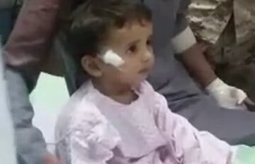 مقذوف حوثي يصيب طفلًا في #نجران