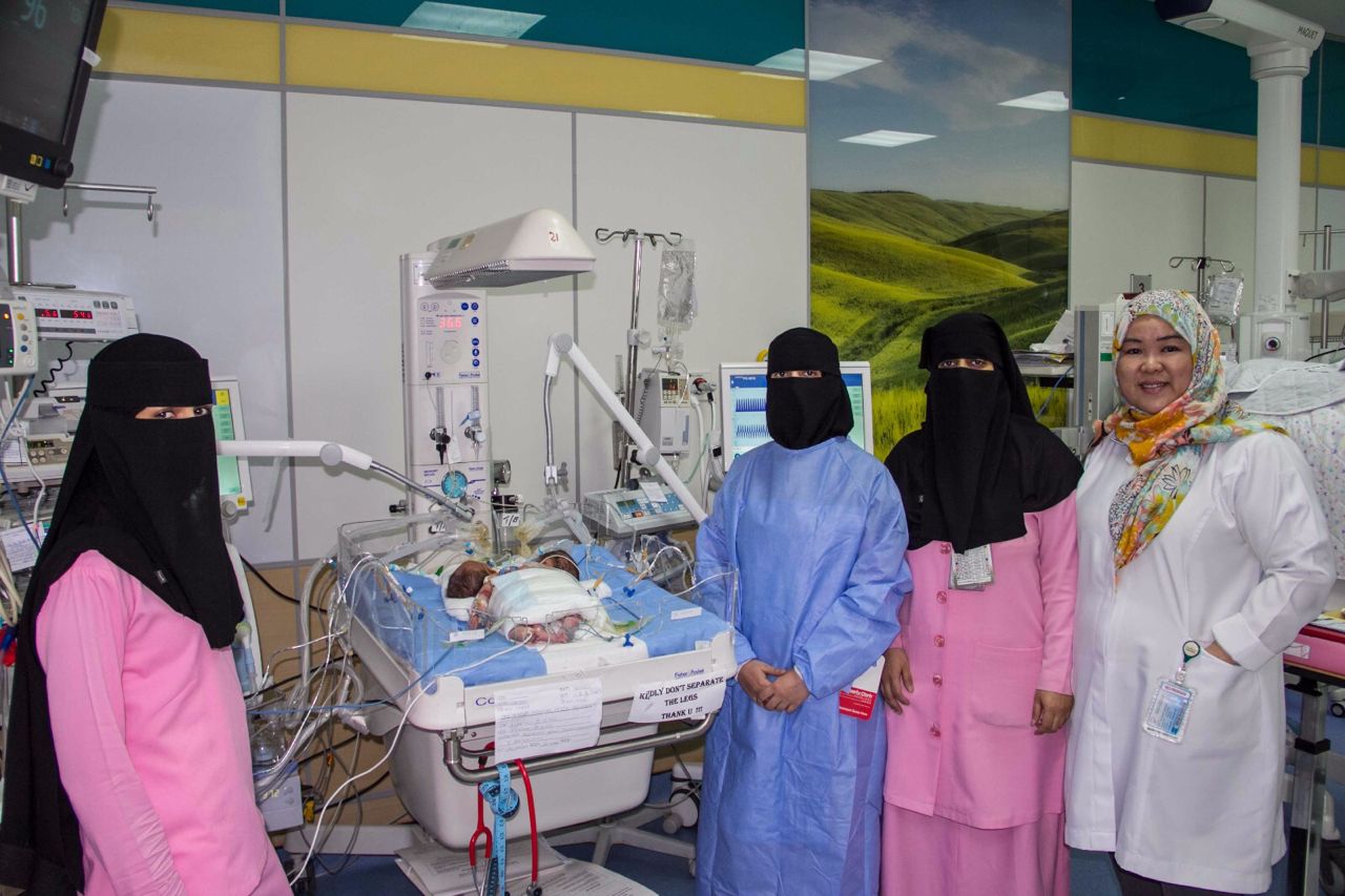 ولادة توأم سيامي يمني الجنسية بمستشفى أبها للولادة والأطفال (1)